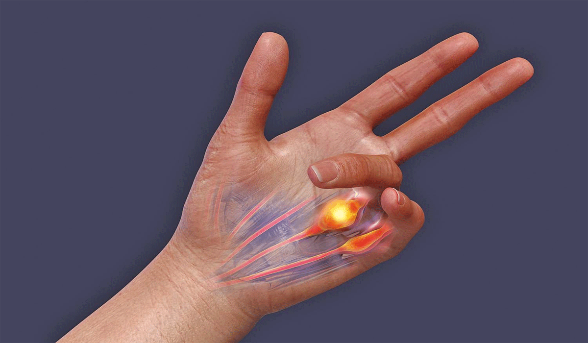 Preventing Common Hand and Finger Problems