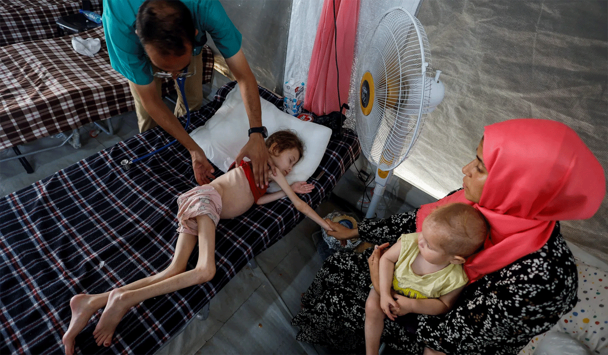 Malnutrition-Related Diseases in Children